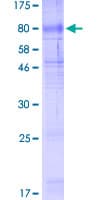 Human SLC40A1 / Ferroportin-1 Protein (Recombinant GST)