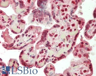 IHC-plus™ SF3B130 / SF3B3 Antibody