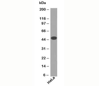 Cytokeratin 1+8 Antibody (clone DA7, Ready-to-Use)