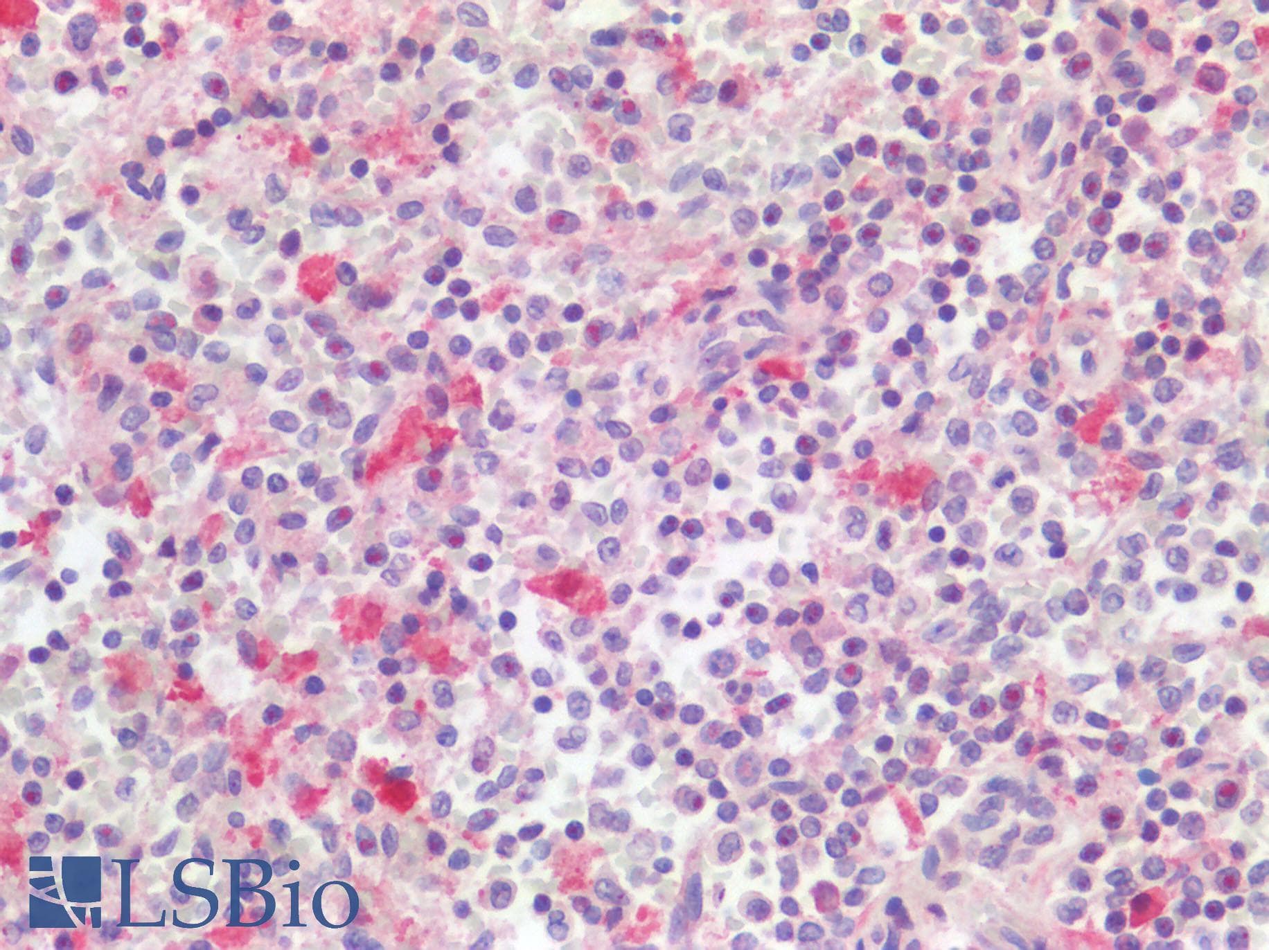 NKP30 Antibody (aa85-134)