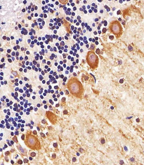 PPT1 / CLN1 Antibody (aa1-306, clone 1117CT11.2.1.4)