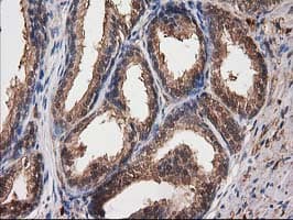 DSTN / Destrin Antibody (clone OTI2F7)
