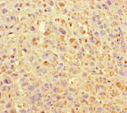 Polyclonal Rabbit anti-Human KIF24 Antibody