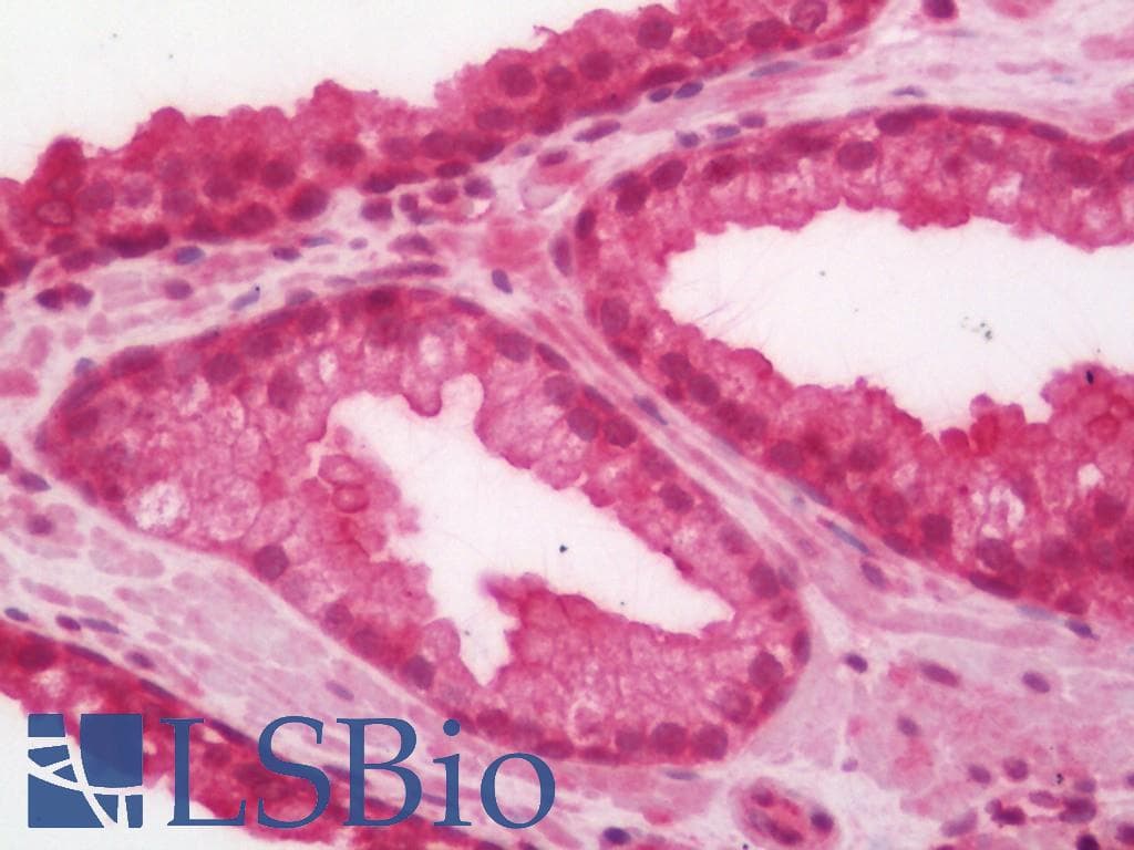 IHC-plus™ Polyclonal Rabbit anti-Human RICTOR Antibody (IHC, WB)