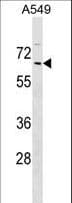 Polyclonal Rabbit anti-Human ZNF675 Antibody (aa136-162, WB)