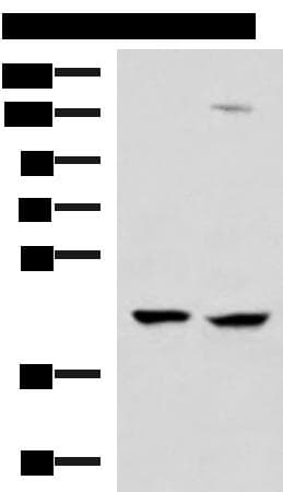 Polyclonal Rabbit anti-Human MAGEC2 / CT10 Antibody (IHC, WB)