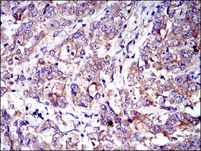 CD6 Antibody (clone 6B9)