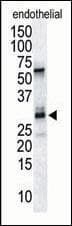 Polyclonal Rabbit anti-Human RCAN1 / DSCR1 Antibody (aa222-252, WB)