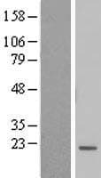 BTF3L4 Protein (Over-Expression Lysate Myc-DDK (Flag))