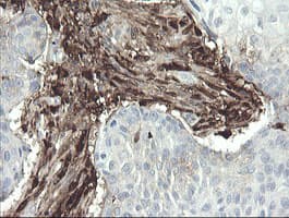 F13A1 / Factor XIIIa Antibody (clone 1H2, Carrier-free)