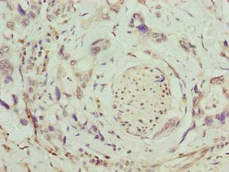 SLC26A8 / TAT1 Antibody