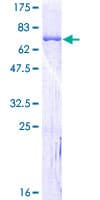 Human SERPINH1 / HSP47 Protein (Recombinant GST)