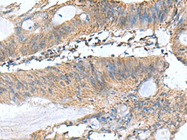 PAFAH1B3 Antibody