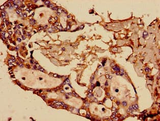 Polyclonal Rabbit anti-Human SST / Somatostatin Antibody