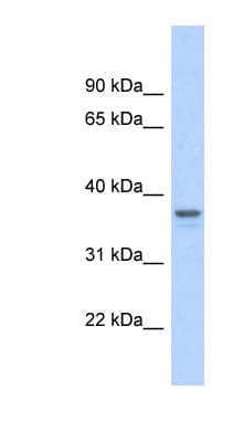 Polyclonal Rabbit anti-Human GAPDH Antibody (aa107-156, WB)