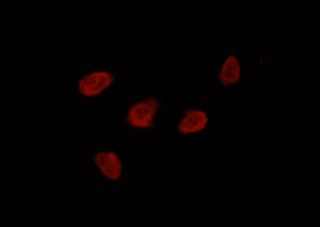 Polyclonal Rabbit anti-Human HDAC8 Antibody (IHC, IF, WB)