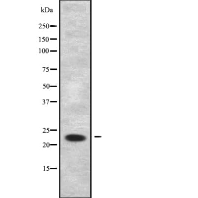 TC21 / RRAS2 Antibody