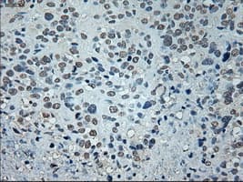 Monoclonal Mouse anti-Human GAD1 / GAD67 Antibody (clone OTI3G9, IHC, WB)