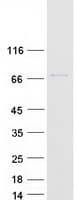 Human TIGD6 Protein (Recombinant Myc-DDK (Flag))