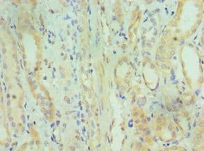 DHRS2 / HEP27 Antibody (aa1-300)