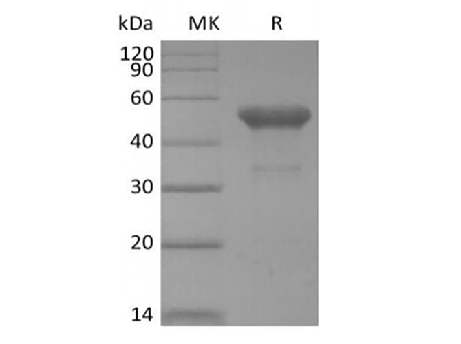 Human PVRIG Protein (Recombinant Fc, C-terminus)