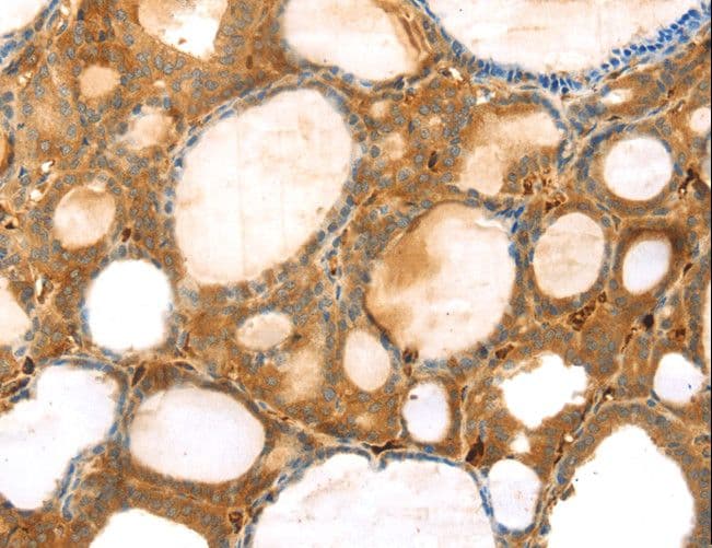 Polyclonal Rabbit anti-Human TMPRSS11F Antibody (IHC, WB)