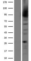 MALT1 Protein (Over-Expression Lysate Myc-DDK (Flag))