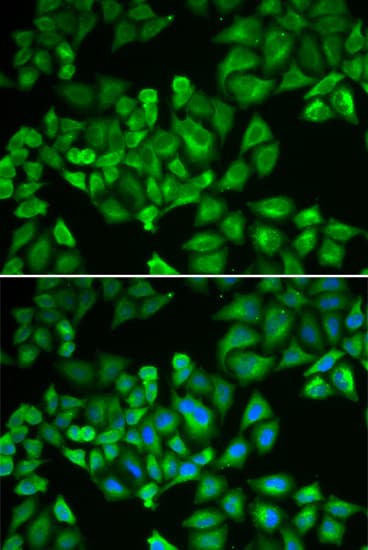 FTL / Ferritin Light Chain Antibody