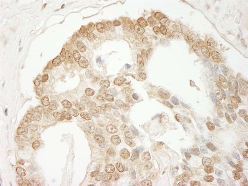 Polyclonal Rabbit anti-Human SDE2 / C1orf55 Antibody (aa350-400, IHC)