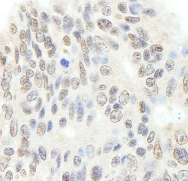 TOP2B / Topoisomerase II Beta Antibody (aa1475-1525)