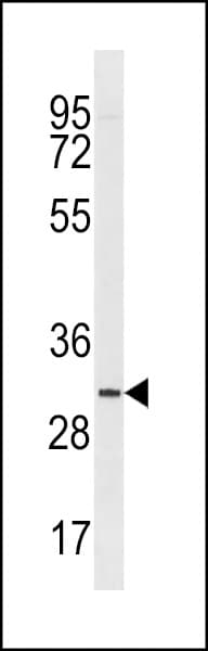 IHC-plus™ TMIGD2 Antibody (aa119-147)