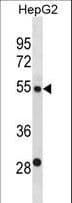 Polyclonal Rabbit anti-Human ST6GAL2 Antibody (aa483-509, WB)