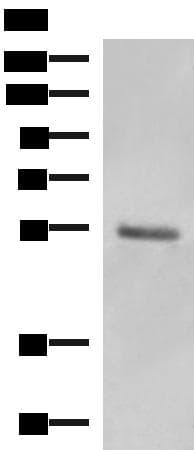 Polyclonal Rabbit anti-Human KRT36 / Keratin 36 / KRTHA6 Antibody (IHC, WB)