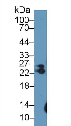 MYL6B Antibody (aa5-199, APC)