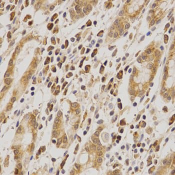 MDM2 Antibody