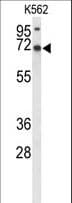 LRRC4 Antibody (aa531-559)