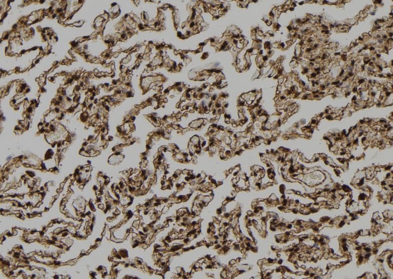 Polyclonal Rabbit anti-Human NNA1 / AGTPBP1 Antibody (IHC, WB)