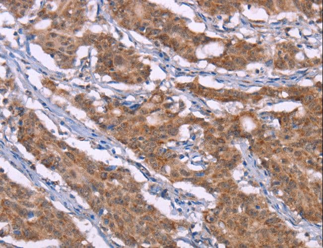 HRH3 / Histamine 3 Receptor Antibody