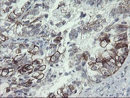 SLA2 / SLAP2 Antibody (clone OTI3A7)