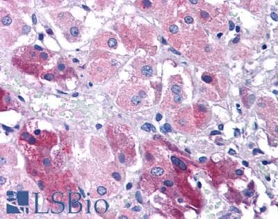 IHC-plus™ TNIP3 Antibody