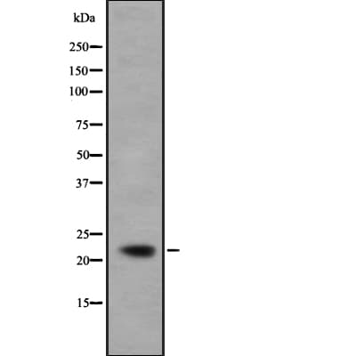 IFNA5 / Interferon Alpha 5 Antibody