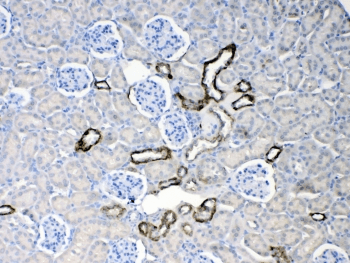Polyclonal Rabbit anti-Human KRT18 / CK18 / Cytokeratin 18 Antibody (IHC, WB)
