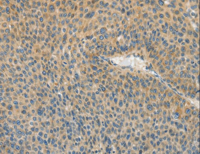 Polyclonal Rabbit anti-Human ASPA Antibody (IHC, WB)