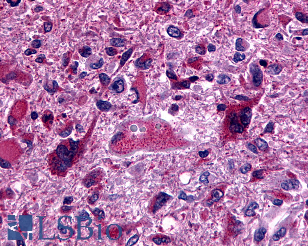 PathPlus™ GPR162 Antibody (Extracellular Domain)