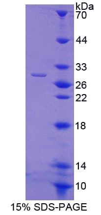 Ubiquitin Protein (Recombinant His-T7)