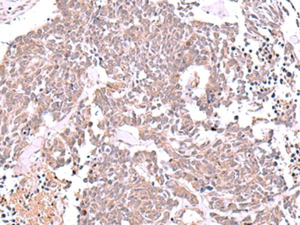 JUNDM2 / JDP2 Antibody