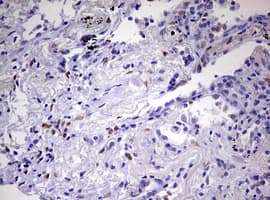PRX-1 / PRRX1 Antibody (clone OTI2B2)