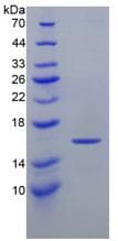 Rat HIF1A / HIF1 Alpha Protein (Recombinant 6His, N-terminus)