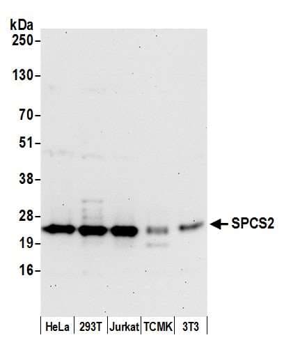 SPCS2 Antibody (aa176-226)