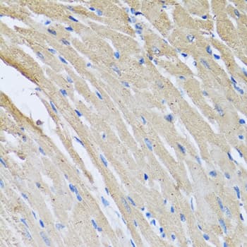 IHC-plus™ Polyclonal Rabbit anti-Human CRHBP Antibody (IHC, IF, WB)